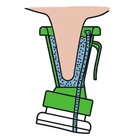 Teat Dip Cup - Non Return